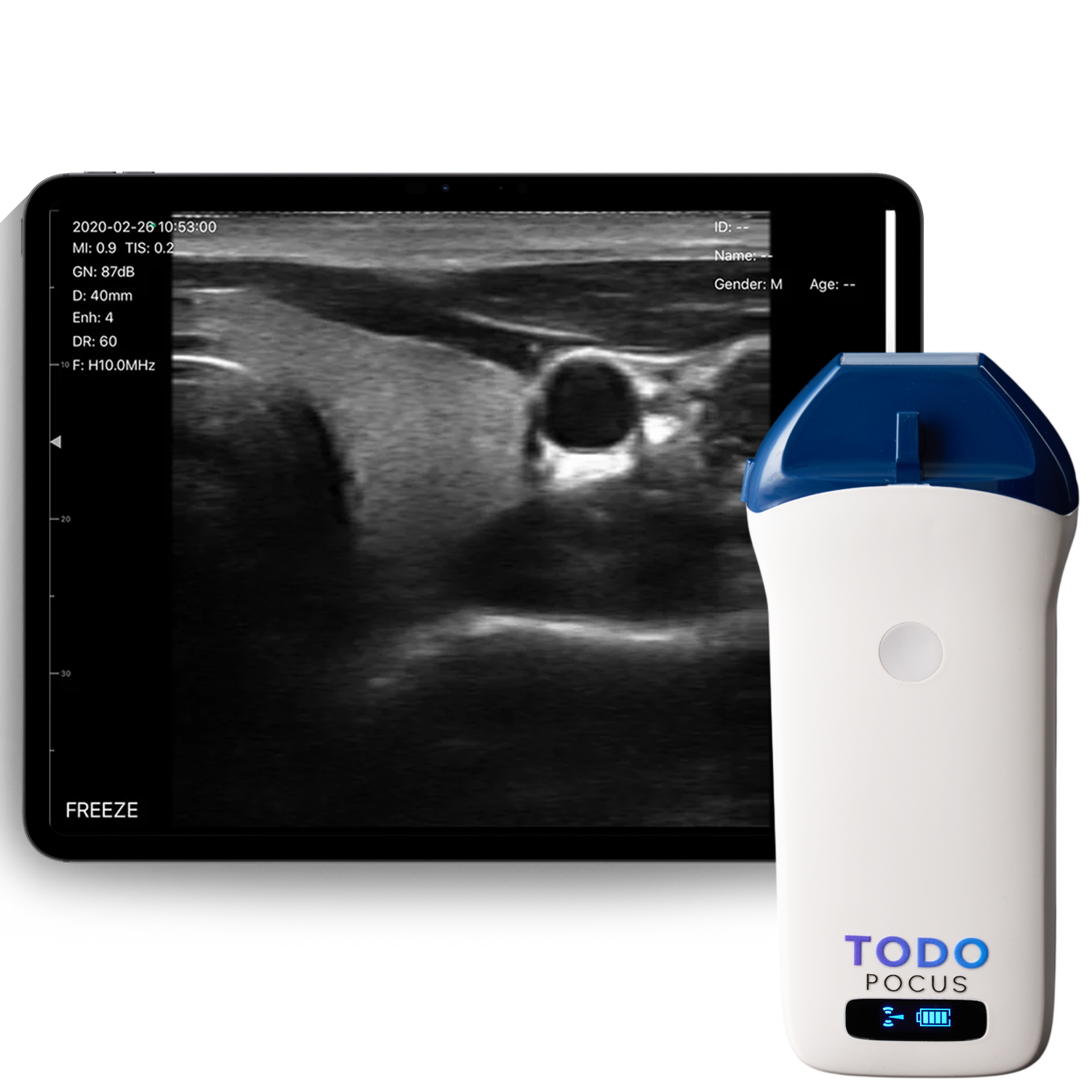 l14 imaging lineare wireless ad alta frequenza ad ultrasuoni l14 imaging lineare wireless ad alta frequenza ad ultrasuoni