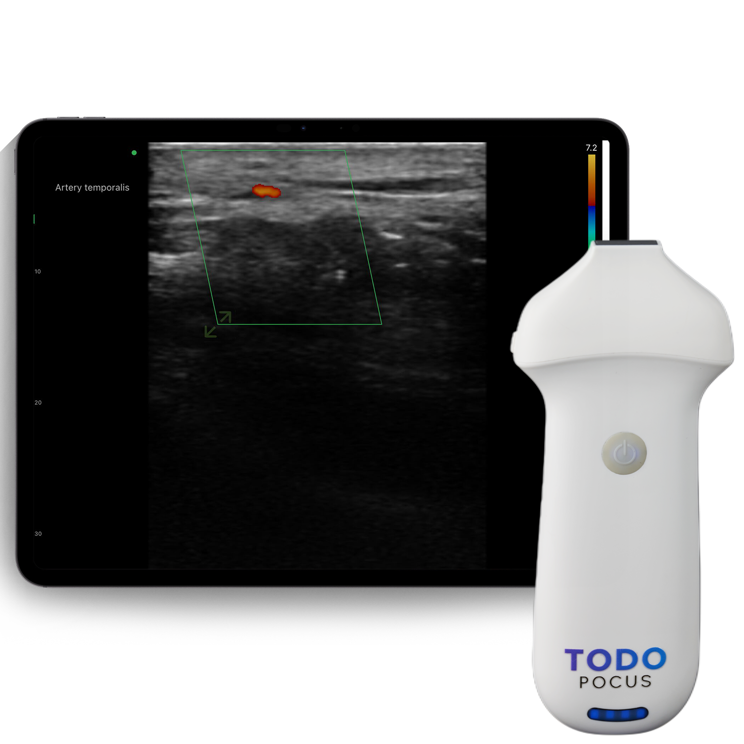 l24 doppler lineare a colori ad alta frequenza 18/24mhz per trattamenti estetici l24 doppler lineare a colori ad alta frequenza 18/24mhz per trattamenti estetici
