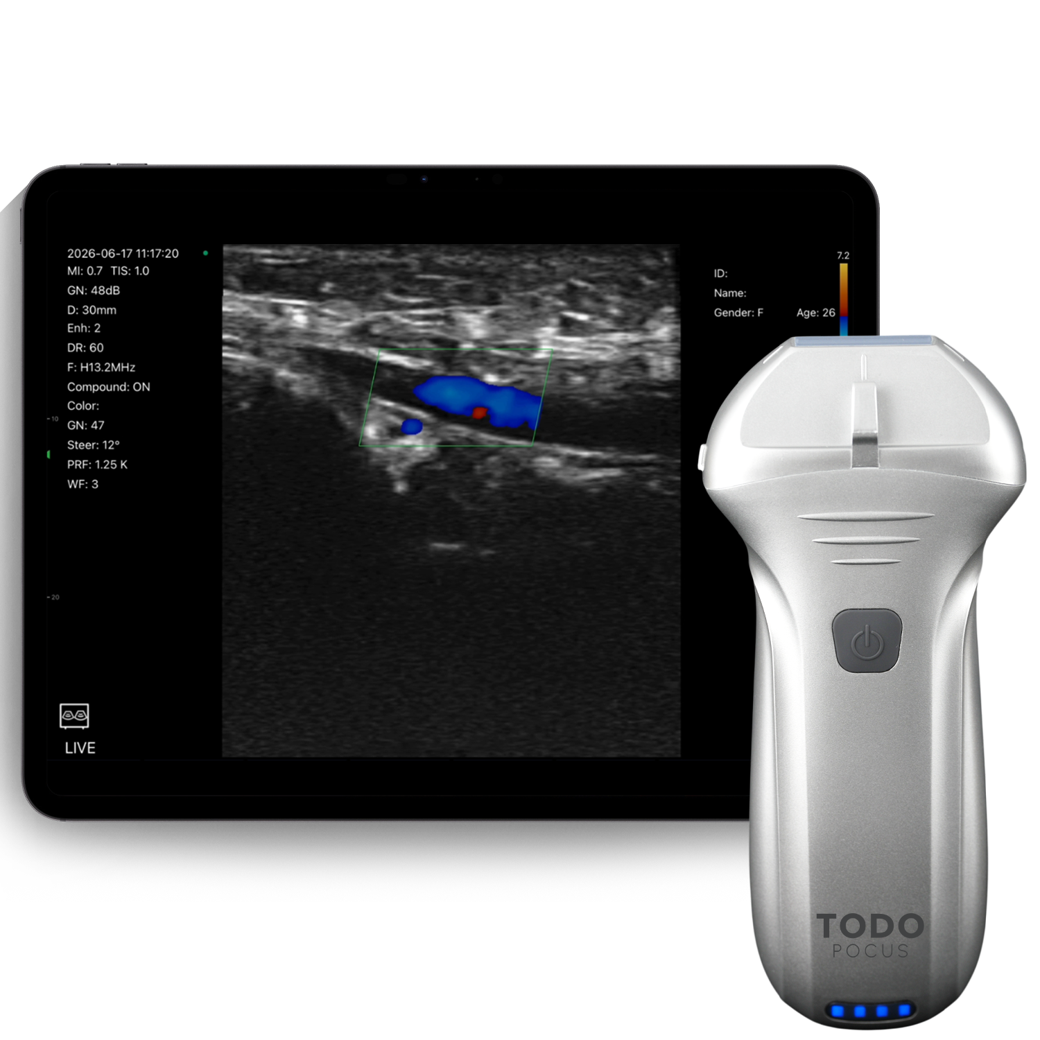 l14pro: ecografo lineare da 10/13,2 MHz per esami vascolari, muscolo-scheletrici e nervosi l14pro: ecografo lineare da 10/13,2 MHz per esami vascolari, muscolo-scheletrici e nervosi