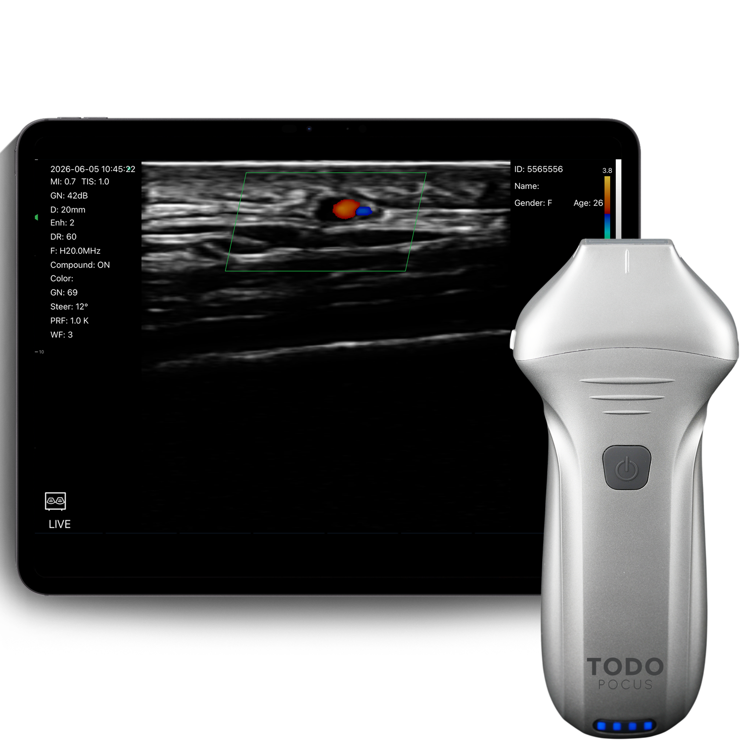 Scanner lineare a frequenza ultraelevata l20pro 16/20 MHz per l'estetica