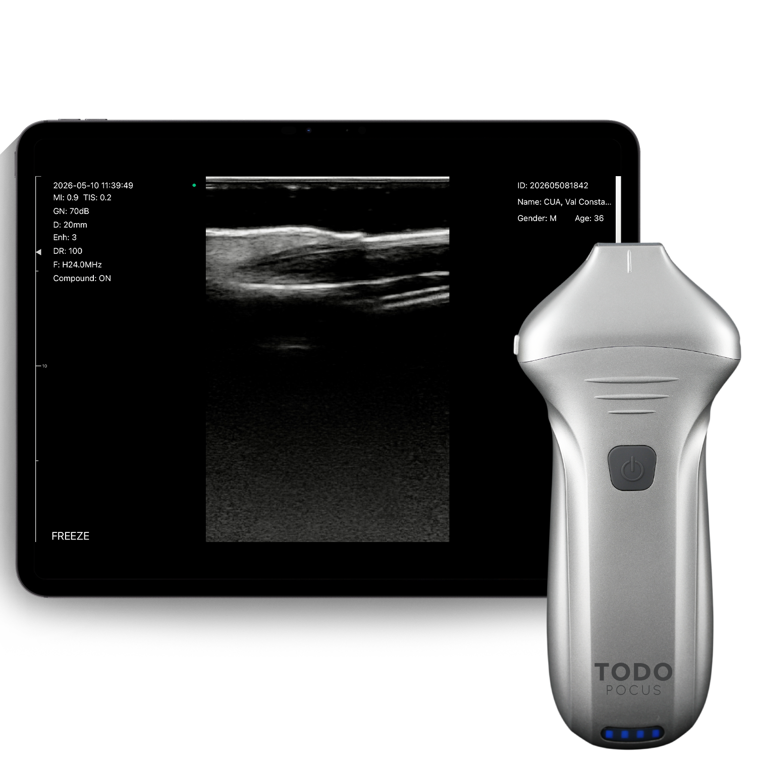 L24Pro Extended-Use Facial Ultrasound Probe for Filler Mapping
