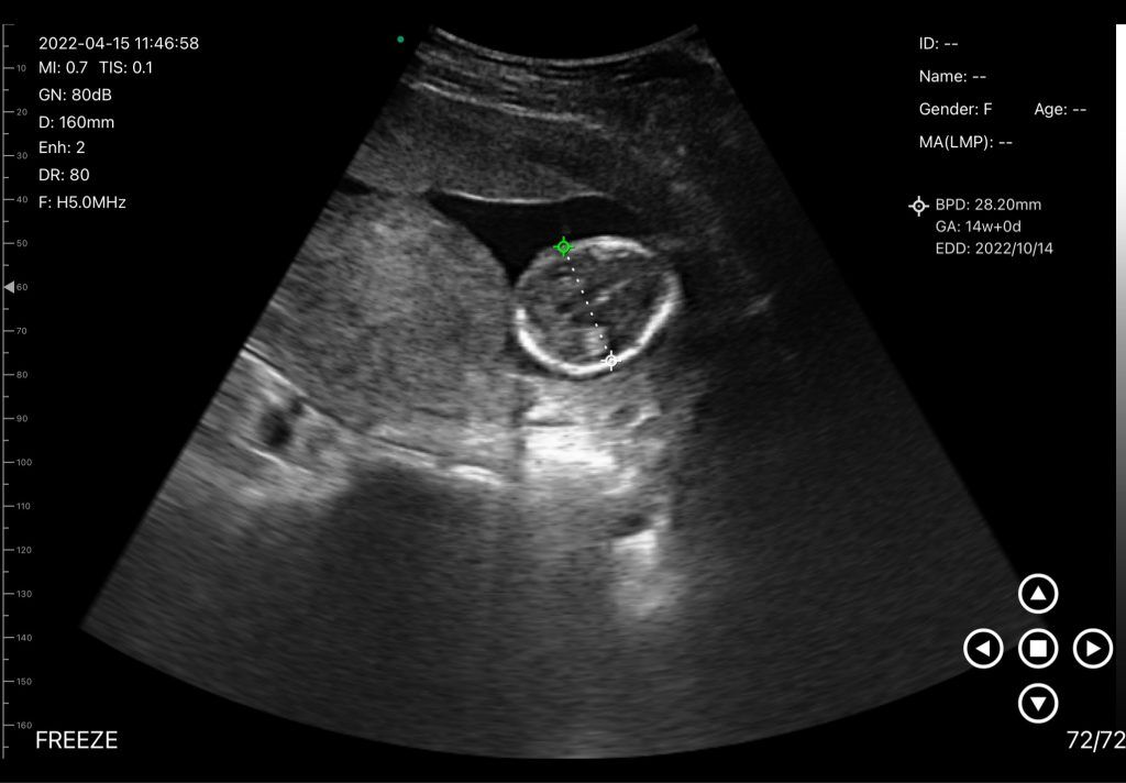 2025年における究極のポイントオブケア超音波価格ガイド
