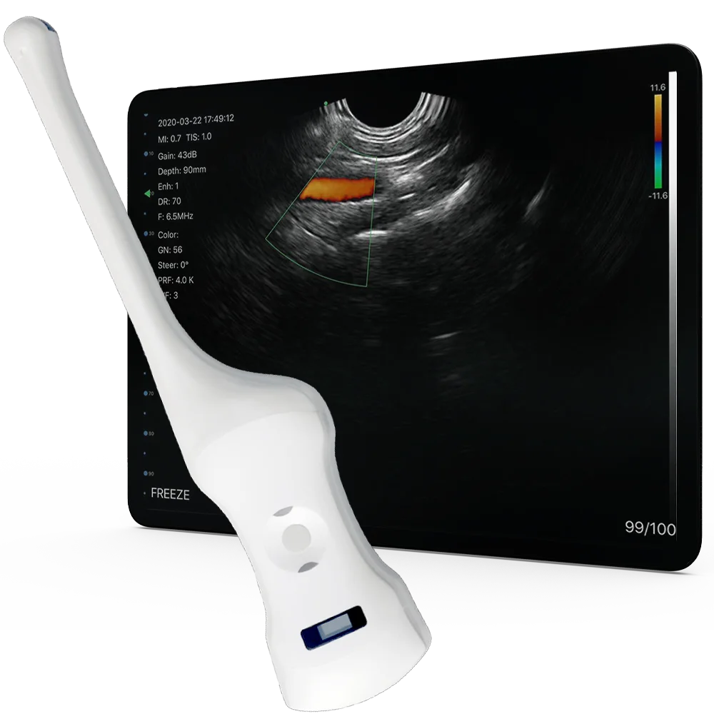 TodoPocus™｜最高のポータブル超音波診断装置の販売