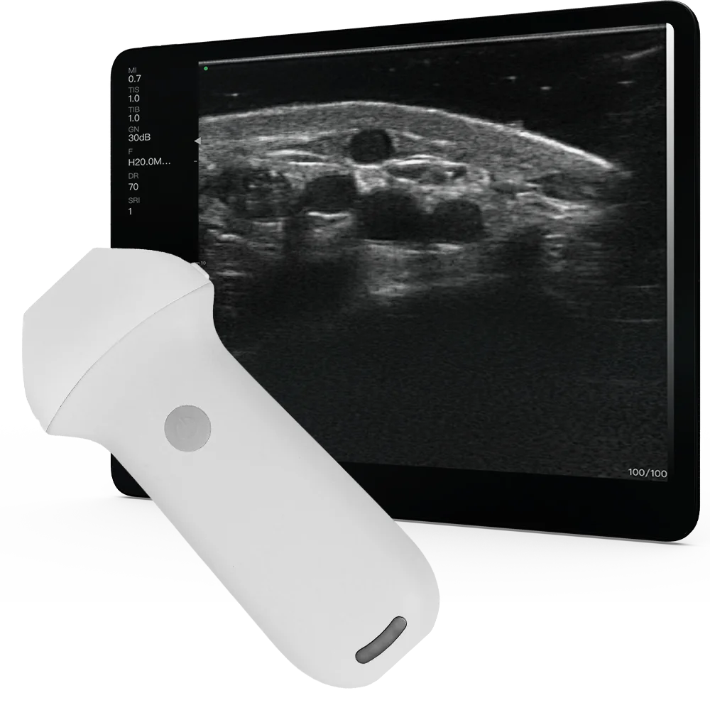 ポータブルエコー　観る透 iViz air コンベックス:イメージギャラリー | 富士フイルム [日本]