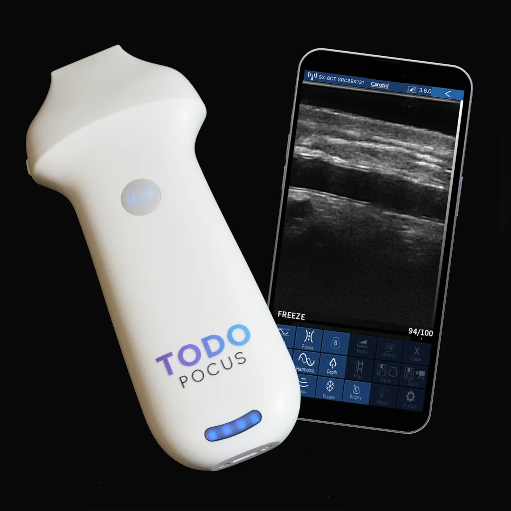 TodoPocus™｜最高のポータブル超音波診断装置の販売