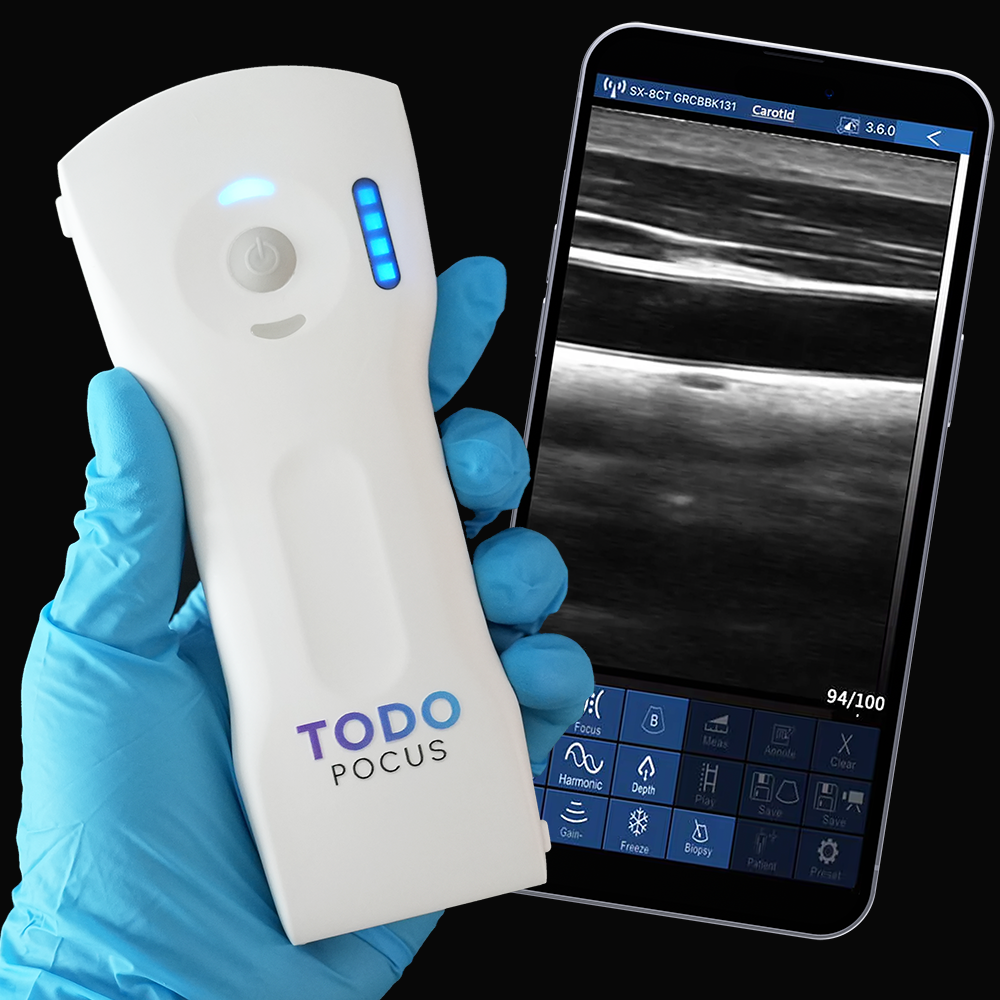 TodoPocus™｜最高のポータブル超音波診断装置の販売