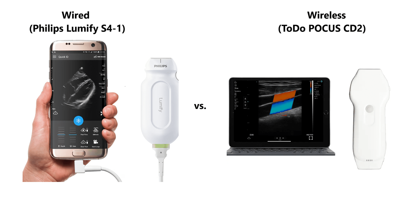 ポータブル超音波診断装置の選び方：ガイド